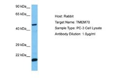 TMEM70 Rabbit anti-Human, Polyclonal, Novus Biologicals 0.1ml; Unconjugated:Antibodies,